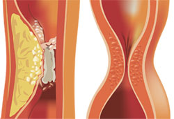 illustrazione medica vene